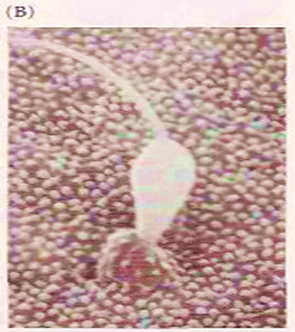 The Acrosome Reaction Image 5