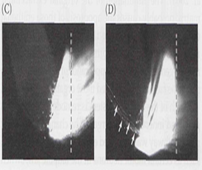 Metamorphosis in Amphibians Image 12