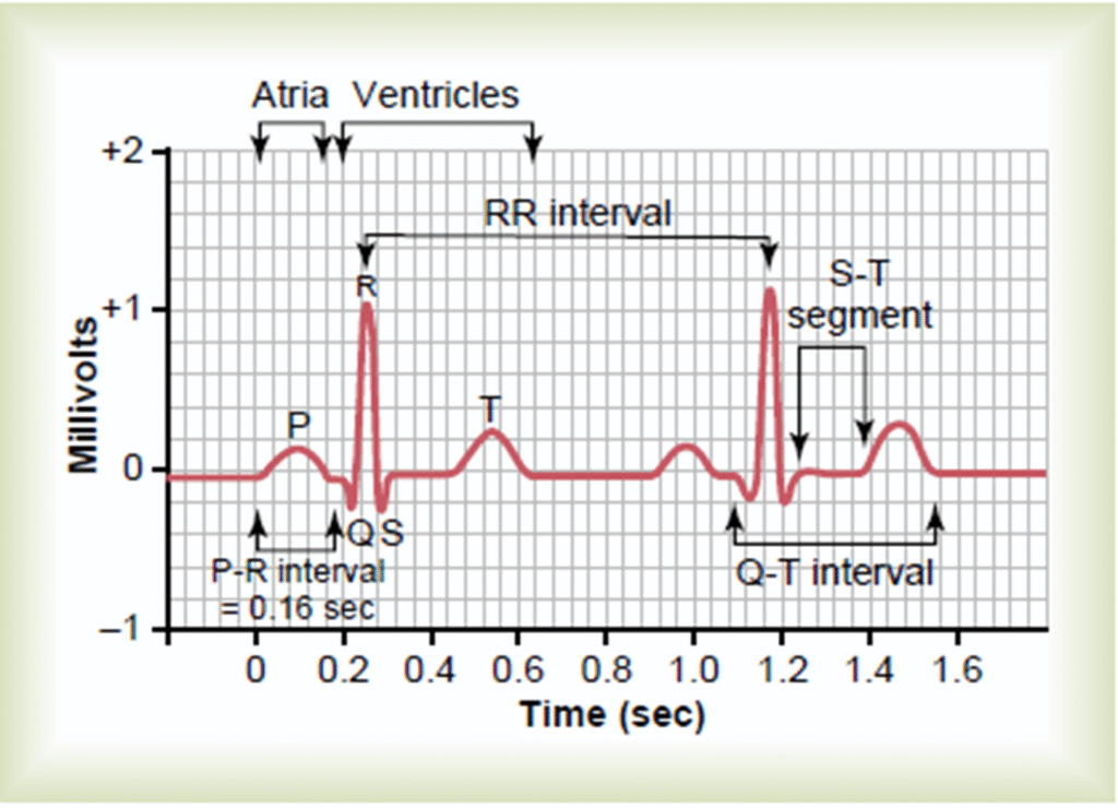 Concept of Electrocardiogram Image 19 1024x740