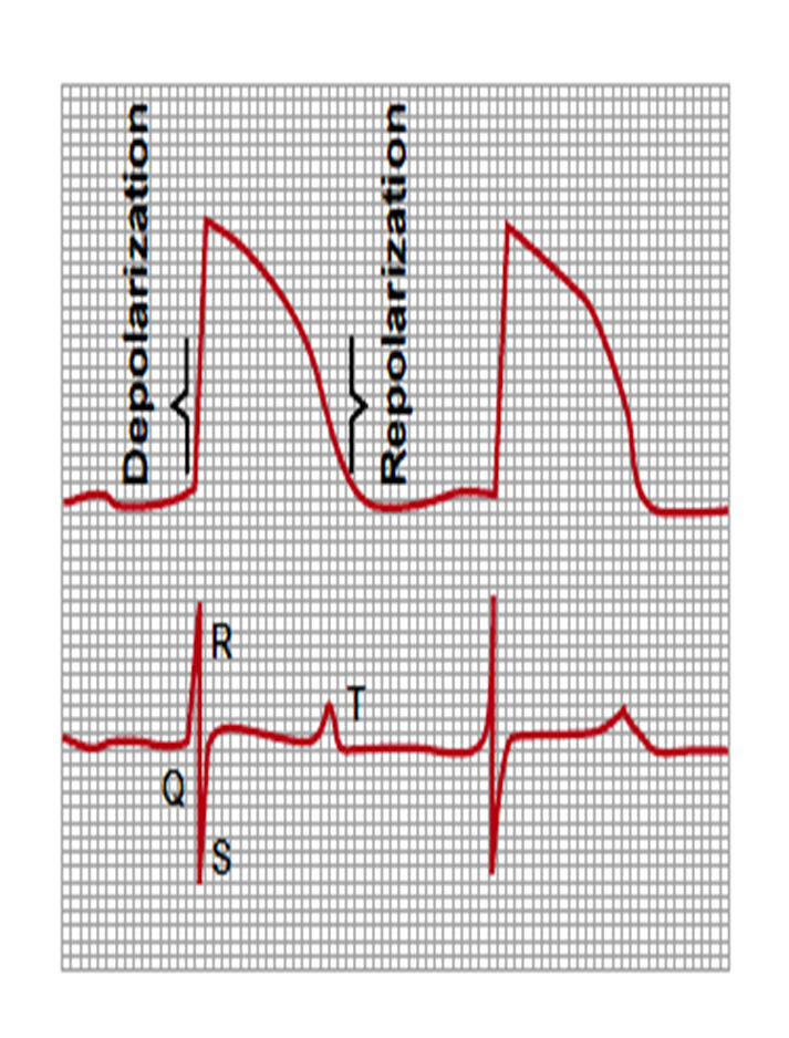 Concept of Electrocardiogram Image 21