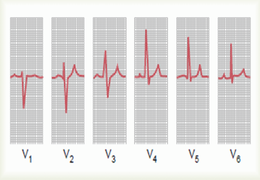 Current flow in the Cardiac cycle Image 27 1024x711