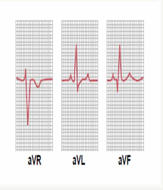Current flow in the Cardiac cycle Image 28