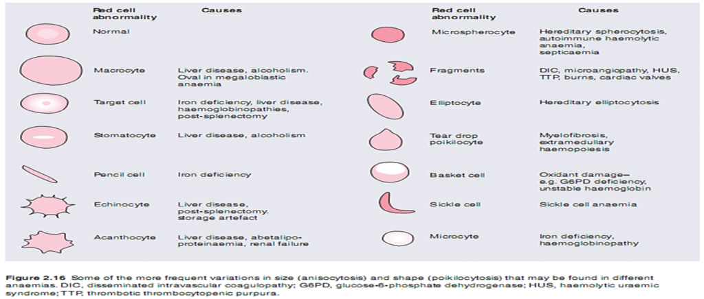 Anemia and its features, symptoms, types image