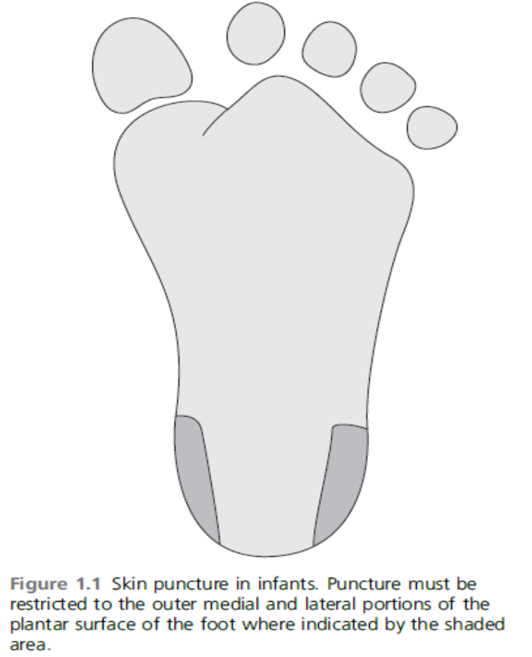 Blood Sampling Techniques image