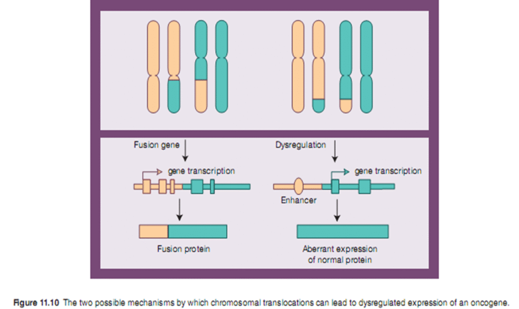 Leukemia its causes and types image