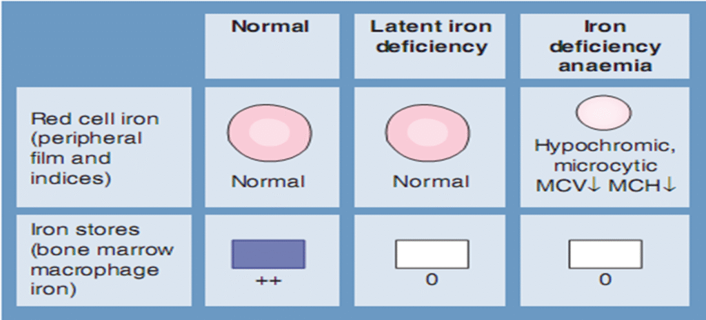 Hypochromic Anemia causes and treatment image