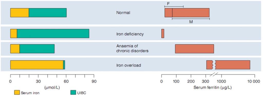 Hypochromic Anemia causes and treatment image