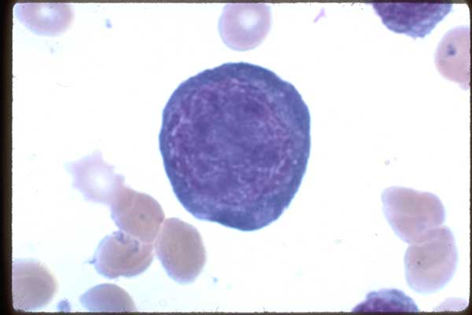 Plasmacytes, Platelets formation image